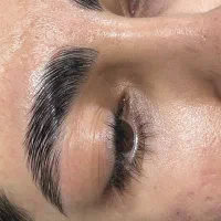 لیفت و بوتاکس ابرو