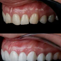 دندانپزشکی مجهز به بی حسی بدون درد دیجیتالی+اقساط|خدمات آرایشگری و زیبایی|خرم‌آباد, |دیوار