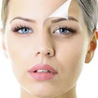 هایفو جوانسازی،لیزر موهای زائد،ریموو تتو،کیوسوییچ