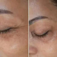 پوست کره ای|خدمات آرایشگری و زیبایی|ارومیه, |دیوار