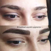 میکرو آفر ویژه روش کرکی مویی ریمو تک جلسه|خدمات آرایشگری و زیبایی|مشهد, آزادشهر|دیوار