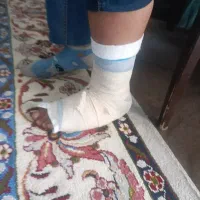 شکسته بندی ،خانم و آقا ، تمام کرج