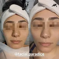 آموزش و پاکسازی و فیشیال تخصصی پوست|خدمات آرایشگری و زیبایی|مشهد, فارغ التحصیلان|دیوار