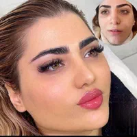 لیزر/هایفو/فیشیال/ژل و بوتاکس/جراحی های سرپایی