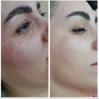 پاکسازی پوست