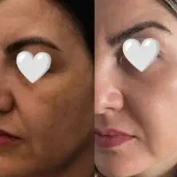 آموزش تخصصی پوست با تخفیف ۵۰ درصدی