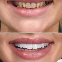 دندانپزشکی|خدمات آرایشگری و زیبایی|قم, دورشهر|دیوار