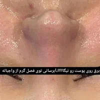 فشیال تخصصی پوست