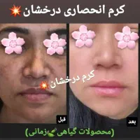 کرم ضدلک و روشن کننده درخشان(بدون بازگشت)