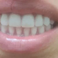 ساخت تخصصی دندان مصنوعی|خدمات آرایشگری و زیبایی|قم, آزادگان|دیوار