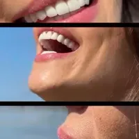 انجام خدمات دندان پزشکی|خدمات آرایشگری و زیبایی|کرج, شهریار|دیوار