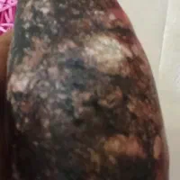 سنگ مرحم یک کیلویی