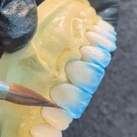 آموزش دندان سازی