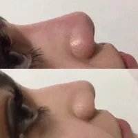 تزریق ژل و بوتاکس|خدمات آرایشگری و زیبایی|بروجرد, |دیوار