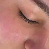 پاکسازی و فیشال