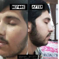 کرم اماراتی اصل، روغن رویش مو و ضد ریزش مو|آرایشی، بهداشتی، درمانی|زهک, |دیوار