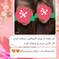 روغن تراپی|آرایشی، بهداشتی، درمانی|اهواز, عامری|دیوار