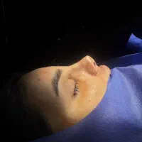 جشنواره عمل بینی