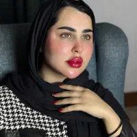 ژل لب/ تخفیف/ فیلر لب/ بوتاکس چشم گربه ای/ مادلینگ