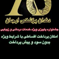 شرایط استثنایی ویژه ایمپلنت،اوردنچر،عصب کشی،مصنوعی|خدمات آرایشگری و زیبایی|تهران, مجیدیه|دیوار