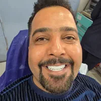 ایمپلنت واحدی ۸،۹۰۰ کره‌ای، اوردنچر با روکش ۸