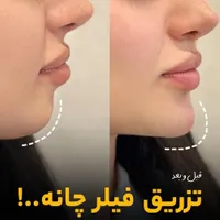 کلینیک زیبایی سلین|خدمات آرایشگری و زیبایی|تهران, خواجه نصیر طوسی|دیوار