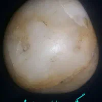 سه هزار قیراط بریل سفید معدنی.و تعدادی سنگ|جواهرات|بهارستان, |دیوار