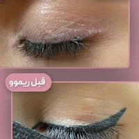 از شر تتو های قدیمی خلاص شو|خدمات آرایشگری و زیبایی|قم, سالاریه|دیوار