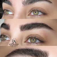 تخفیف میکروبلیدینگ،فیبروز،شیدینگ بهمناسبت افتتاحیه