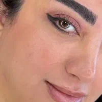 میکروکاشت تضمینی فقط ۱۰ تومن
