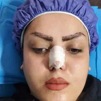 کاشت مو/لیزر مـو زائد/لاغری/فیلر بادی/ نخ و بوتاکس|خدمات آرایشگری و زیبایی|شیراز, گل سرخ|دیوار