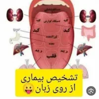 سونوگرافی بدن از روی زبان و کف دست