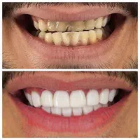 دندانپزشکی کامپوزیت و لمینت دندان|خدمات آرایشگری و زیبایی|مشهد, وکیل‌آباد|دیوار