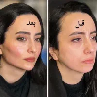 فیلر لب بوتاکس مادلینگ زیرچشم فیلر باسن بیکینی نخ|خدمات آرایشگری و زیبایی|تهران, پاسداران|دیوار