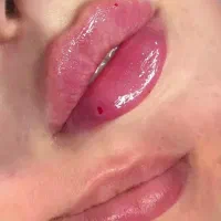 تزریق ژل  بوتاکس  فیلر  پرسینگ|خدمات آرایشگری و زیبایی|قم, نیروگاه|دیوار