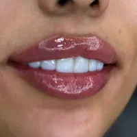 کارشناس تغذیه جهت لاین لاغری