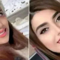 تپلی فوری صورت (چاقی صورت در ۱۰‌روز)|خوردنی و آشامیدنی|رشت, کاکتوس|دیوار