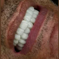 آموزش دندانسازی (ثابت)