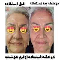 متخصص پوست و موهمراه مشاوره وروتین پیشنهاد محصول