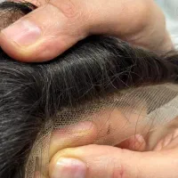 کلینیک مو(پروتز، میکرواسکالپ )