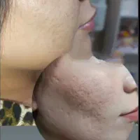 ورکشاپ سه روزه پوست و مو آکادمی و درمانگاه روشاک.
