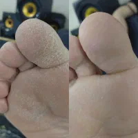 خدمات پدیکور|خدمات آرایشگری و زیبایی|گلپایگان, |دیوار