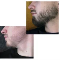 طی یک ماه نواحی خالیتو پر کن
