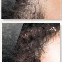 محصولات شرکت نیوشانیک|آرایشی، بهداشتی، درمانی|تهران, شهرک امام خمینی|دیوار