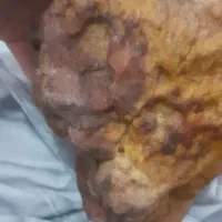 سنگ مجسمه