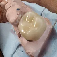 نیاز به نیروی کارآموز دندانسازی لابراتوار بخش ثابت