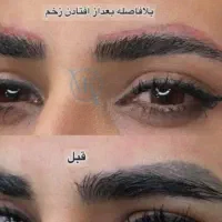 مدل