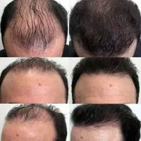 بااکسونیک احیاش کن