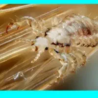 پاکسازی شپش