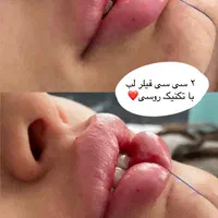 جشنواره تخفیفات لیزر الکساندرایت کوانتا۲۰۲۴|خدمات آرایشگری و زیبایی|قم, زنبیل آباد|دیوار